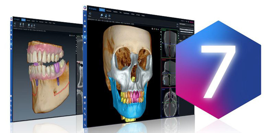 Bildgebungssoftware Romexis® 7 mit integrierter KI jetzt verfügbar