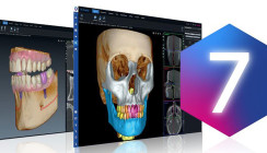 Bildgebungssoftware Romexis® 7 mit integrierter KI jetzt verfügbar