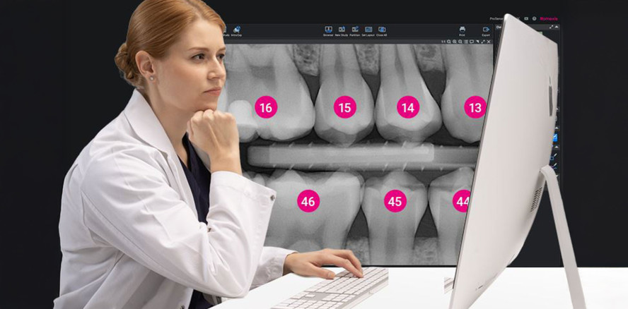 KI-Werkzeuge für die intraorale Bildgebung jetzt für Planmeca Romexis® 7 verfügbar