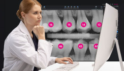 KI-Werkzeuge für die intraorale Bildgebung jetzt für Planmeca Romexis® 7 verfügbar