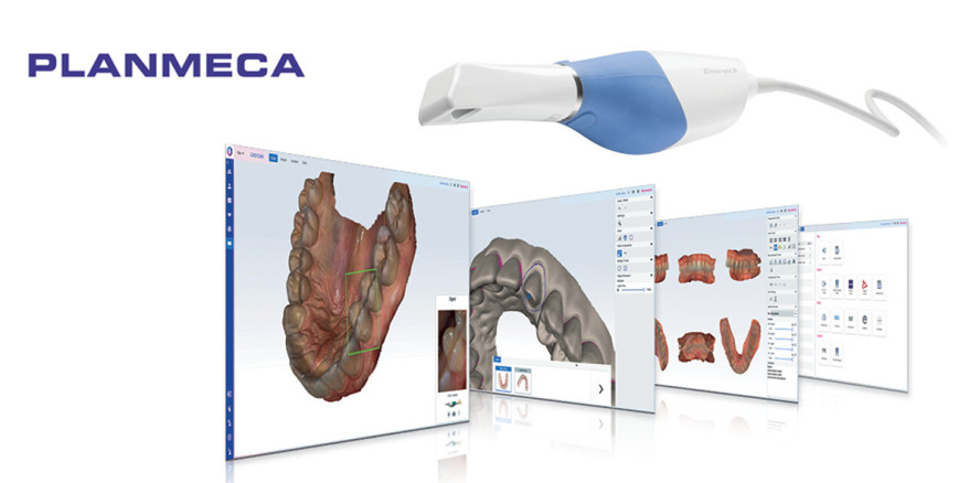 Neues Niveau bei digitalen Abdrücken mit Planmeca Romexis® CAD/CAM
