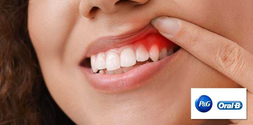 Studie zeigt: Prävention von Zahnfleischerkrankungen lohnt sich