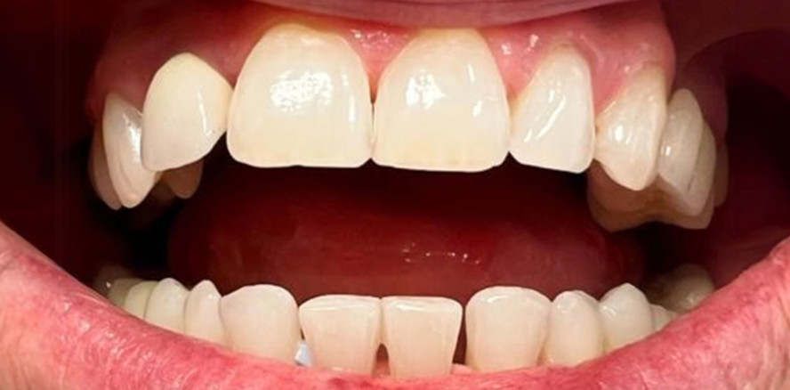 SDI Pola Office – eine Erleichterung für Patienten und den Praxisablauf