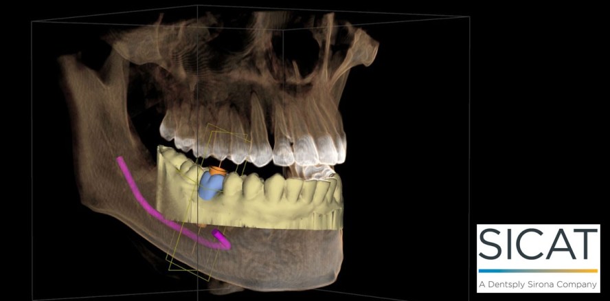 Fortsetzung des erfolgreichen Seminarangebots von SICAT