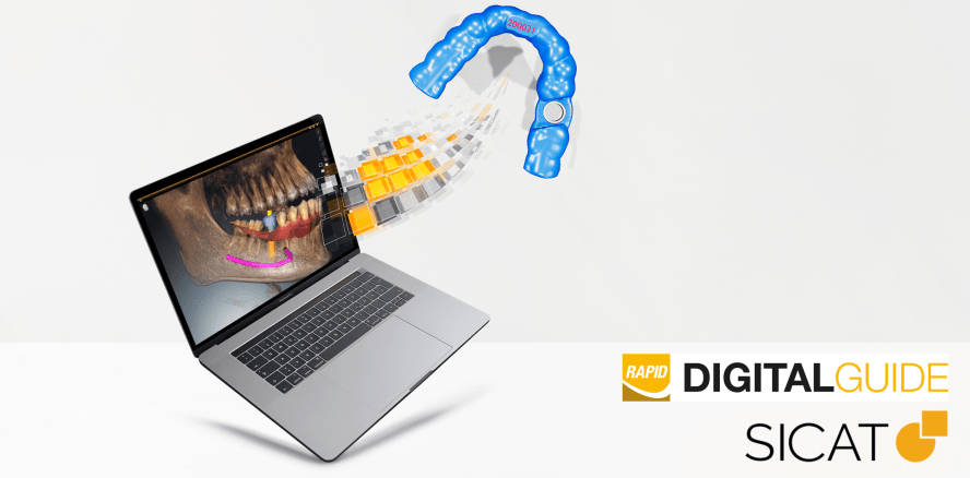 Neu: SICAT RAPID DIGITALGUIDE – powered by artificial intelligence