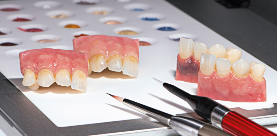 Paint 3D – ein intuitives und universelles Malfarbsystem für dentale Keramiken