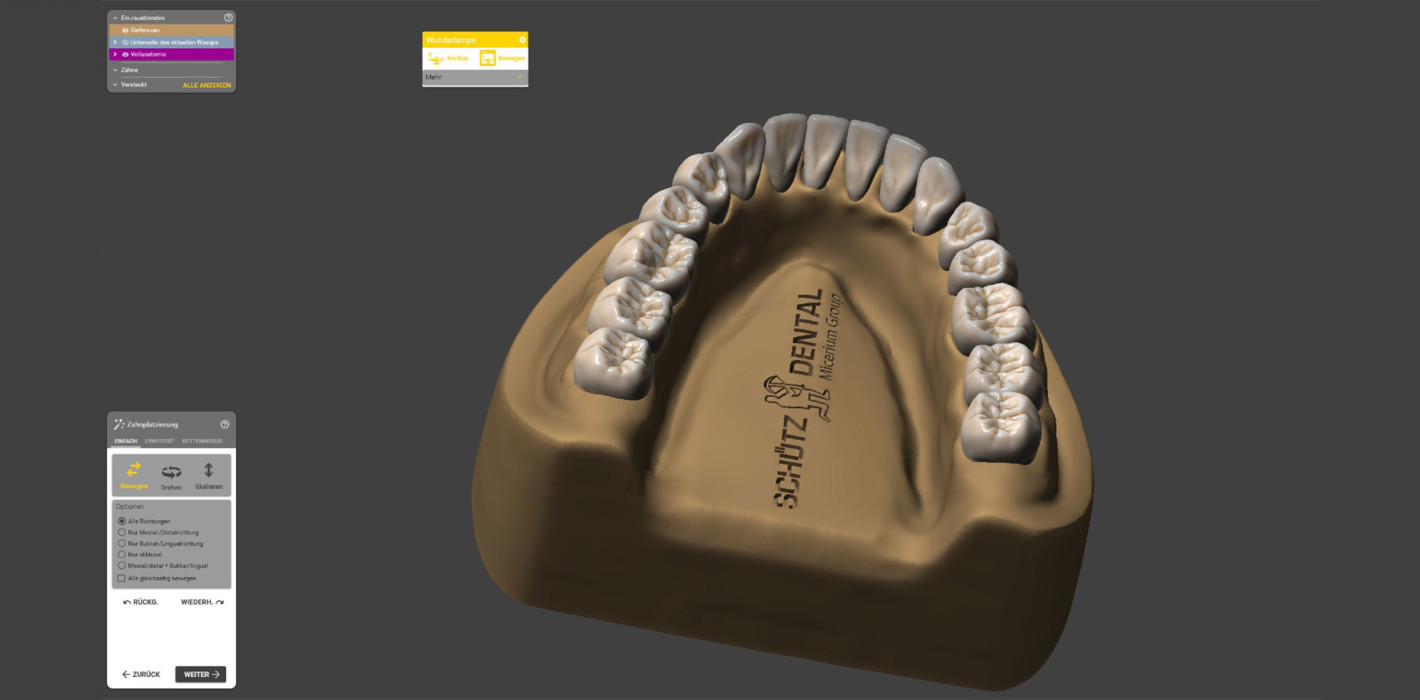 Erweiterte Exocad-Zahnbibliothek exklusiv bei Schütz Dental