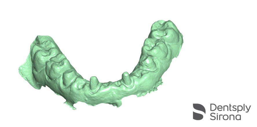 CEREC, ein Gesamtsystem für Restaurationen, Implantologie und Kieferorthopädie