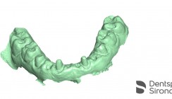 CEREC, ein Gesamtsystem für Restaurationen, Implantologie und Kieferorthopädie
