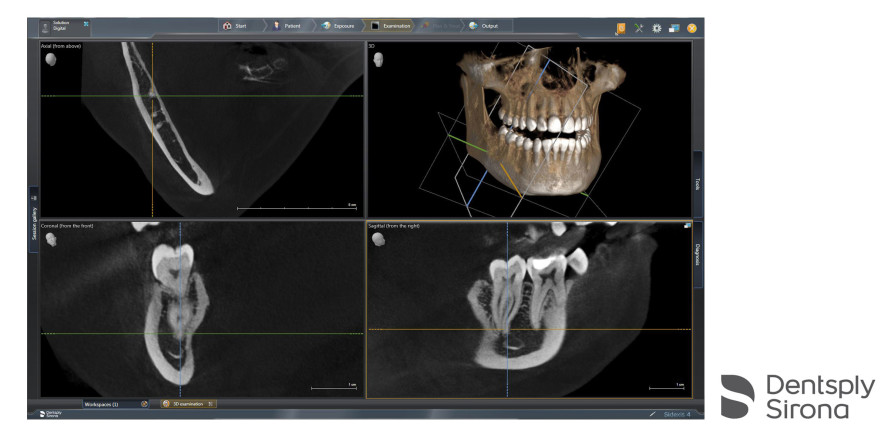 Dentsply Sirona: Neue Softwareversion Sidexis 4