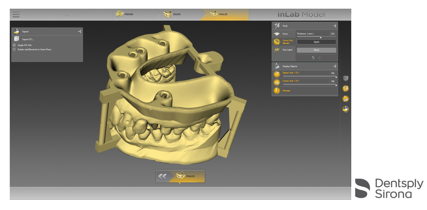 inLab Software Update 18.0 bereichert zahntechnischen CAD/CAM-Workflow