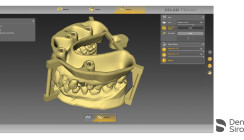 inLab Software Update 18.0 bereichert zahntechnischen CAD/CAM-Workflow