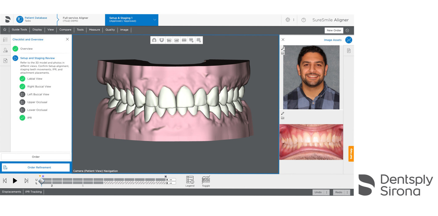 SureSmile Software7.6:  Optimal für individuelle Behandlungskonzepte