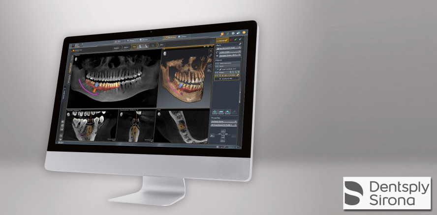 Moderne und intuitive Implantologie mit Sidexis 4 und der neuen SICAT Implant 2.0