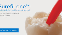 Surefil one: fünf Farben, nur eine Schicht, kein Adhäsiv