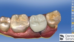 CEREC: Offenes CAD/CAM-Gesamtsystem mit intelligenter Software