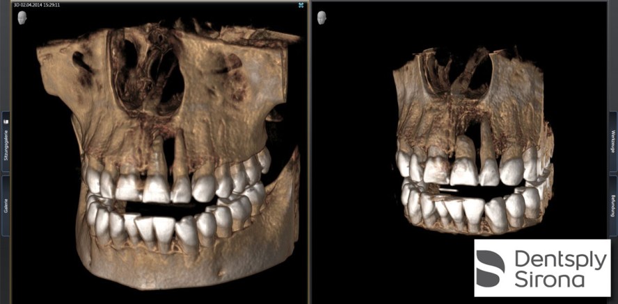 Goldstandard 4.2: Neue Features in der Röntgensoftware Sidexis 4