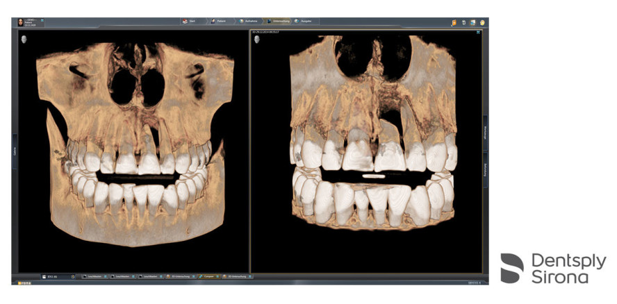 Sidexis 4: Optimale Vernetzung von bildgebenden Systemen