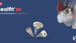 Scan, Shape, Heal - mit dem HealFit® SH von Anthogyr