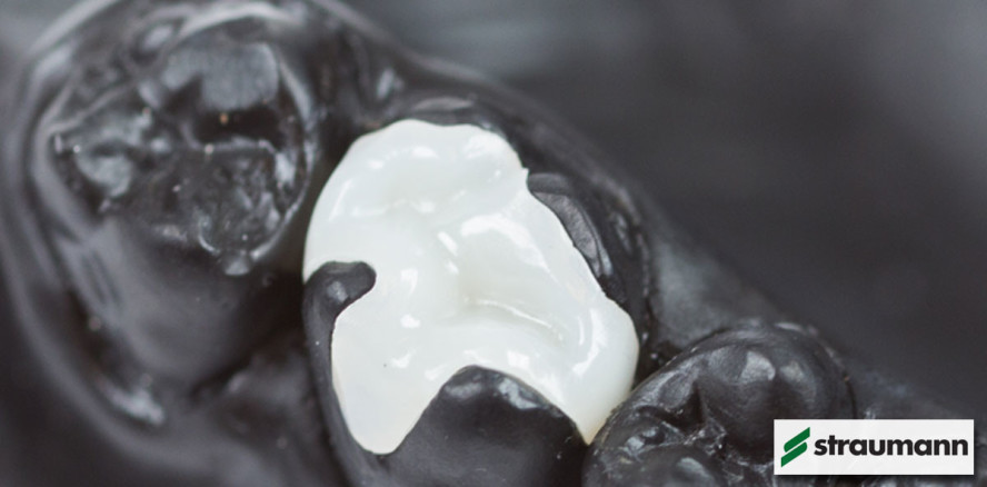 Die zeitgemäße Wahl für Chairside-CAD/CAM