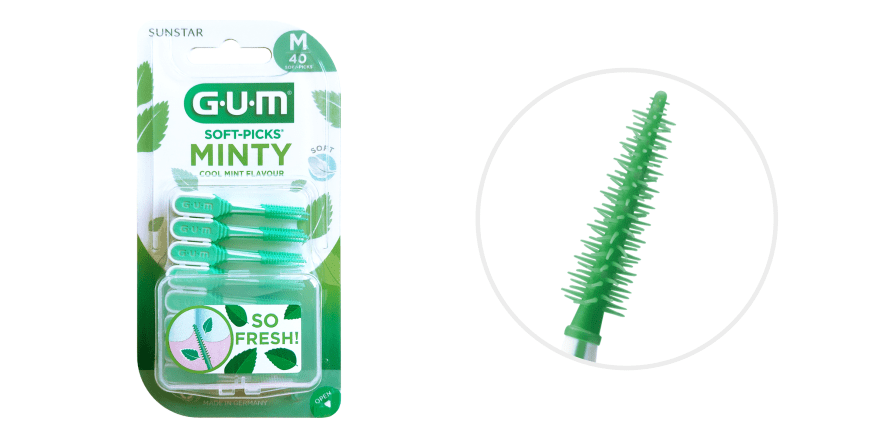 Korrekte Interdentalreinigung bei Zahnfleischerkrankungen