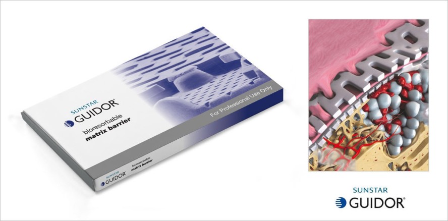 Gewebe- und Knochenregeneration: Innovative Präparate für eine optimierte Wiederherstellung