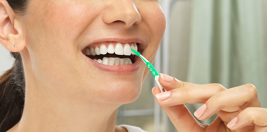 Warum die Reinigung der Zahnzwischenräume so wichtig ist