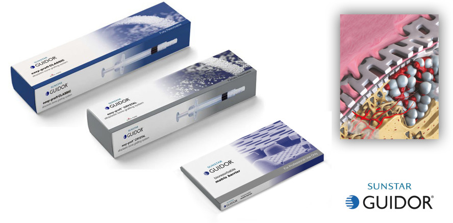 GUIDOR® – Zähne, Gewebe und Implantate erhalten