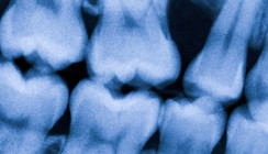 Zum Röntgen innerhalb der PAR-Behandlungsstrecke