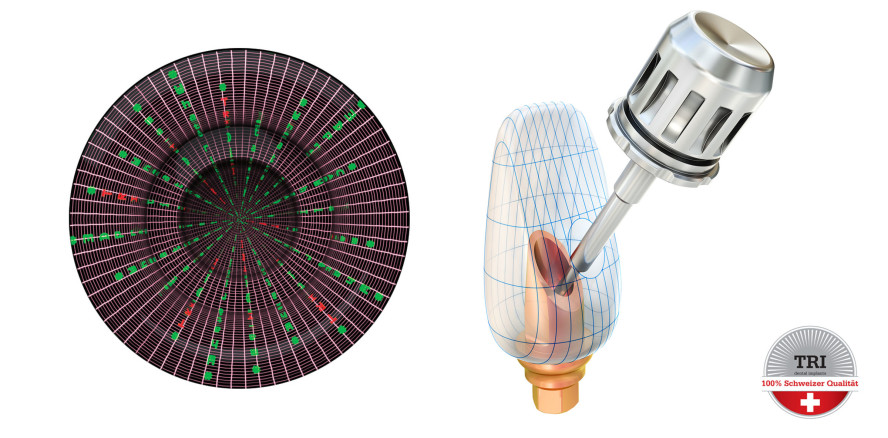 TRI® präsentiert das erste digitale Implantat der Welt