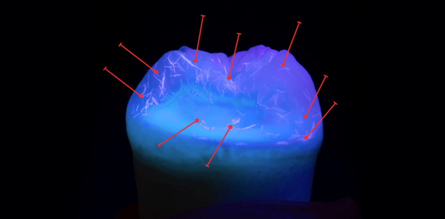 ZerofloX™: Eine neue Ära in der Applikation von Dentalmaterialien