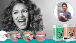 Opalescence Go® – Für moderne Praxen
