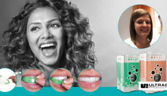 Opalescence Go® – schnell und bequem