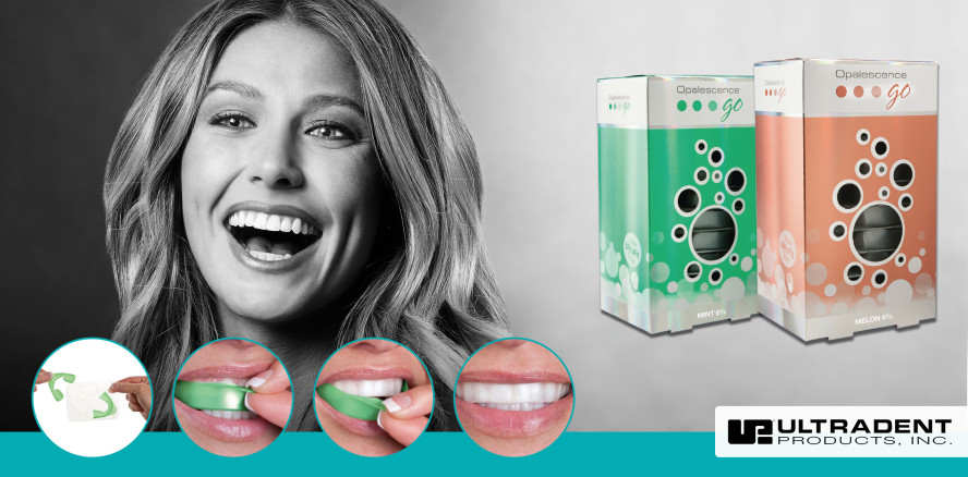 „Opalescence Go® kommt bei unseren Patienten an“