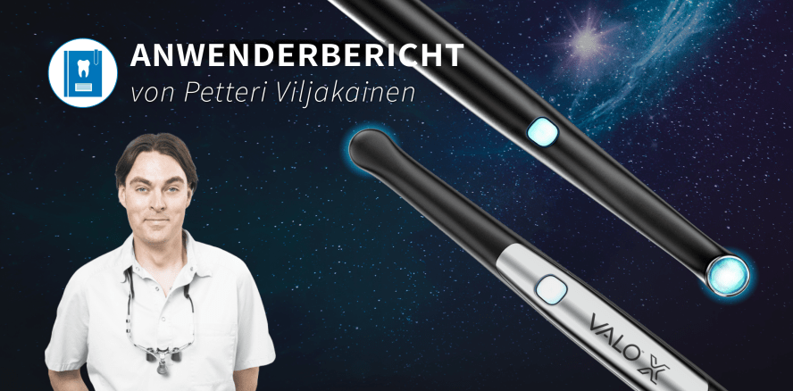 Flexibilität ist das A und O bei Polymerisationsleuchten