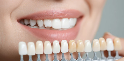 Rechtliche Fakten statt Mythen: Zahnaufhellung mit über 6% Wasserstoffperoxid