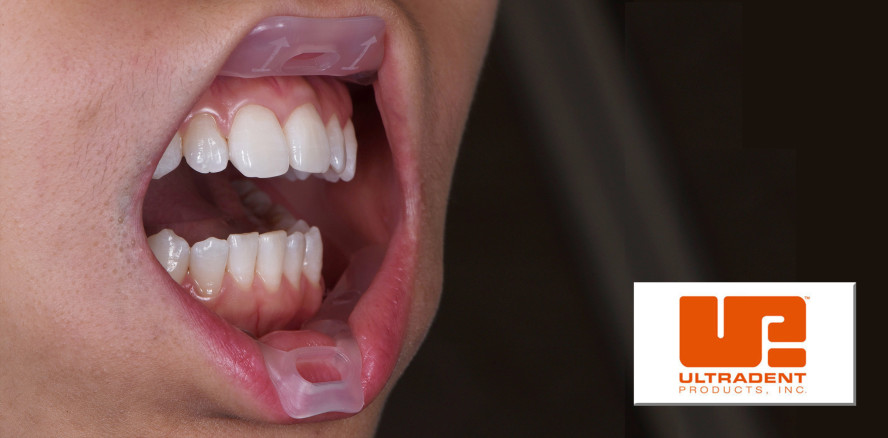 Vereinfachung von Behandlungsprozessen mit neuartigem Retraktor