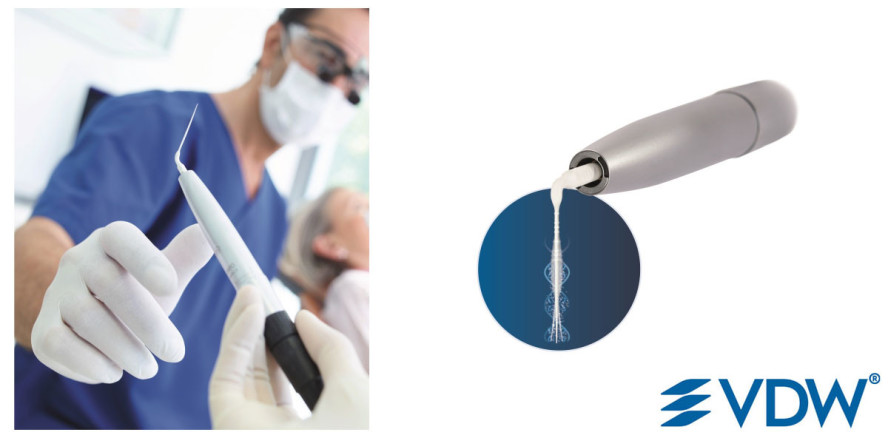 Musteraktion für EDDY® – die schallaktivierte Spülinnovation von VDW