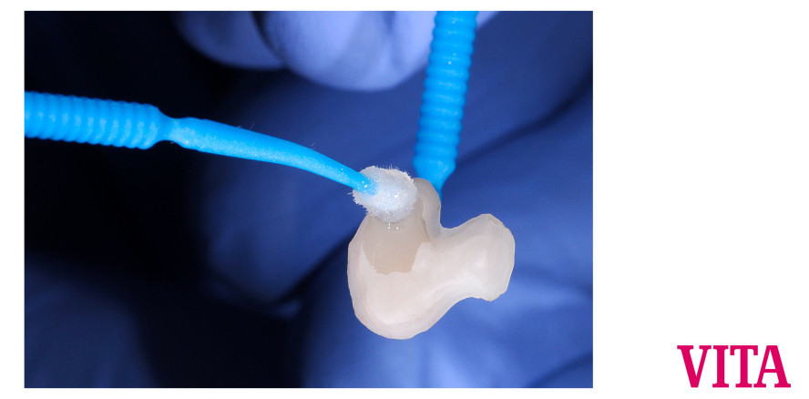 Das Inlay mit dem Chamäleoneffekt: supertransluzentes VITA ENAMIC® ST