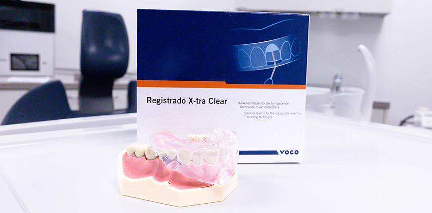 Registrado X-tra Clear: Direkte Compositerestau&shy;rationen mit Injection Moulding Technique