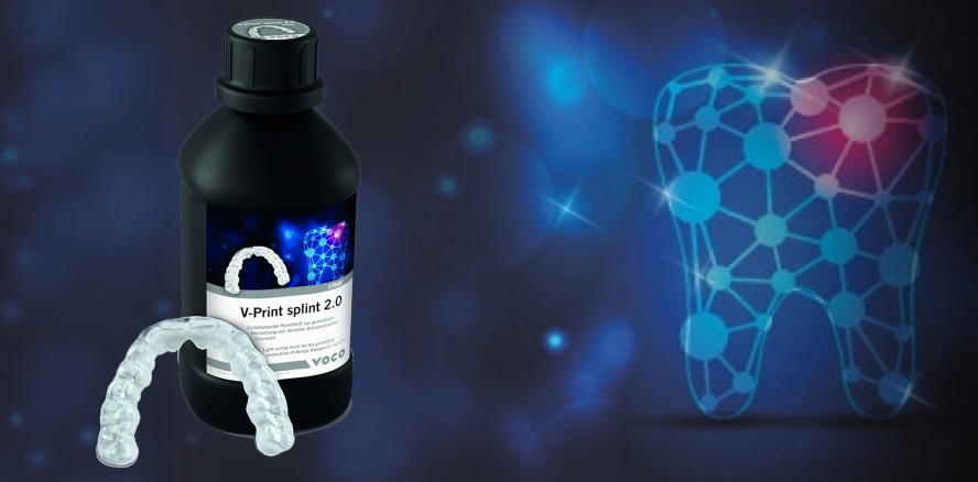 Langlebige Schienen mit V-Print splint 2.0 von VOCO