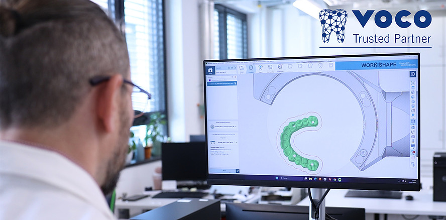 CAM-Kompetenz trifft Materialexpertise: VOCO und WORKXSHAPE starten Kooperation