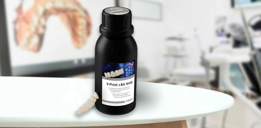 V-Print c&b temp – Composite-Provisorien aus dem 3D-Drucker