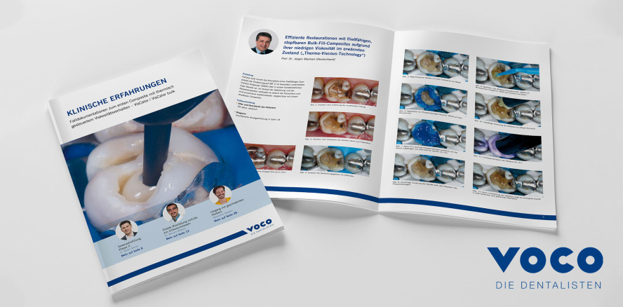 Experten-Meinungen zu VisCalor und VisCalor bulk