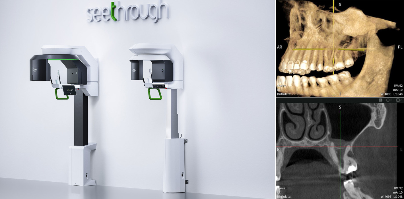 High-End DVT-Bildgebung – Seethrough Max und Seethrough Flex