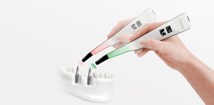 Lösungen zur Implantatstabilitätsmessung
