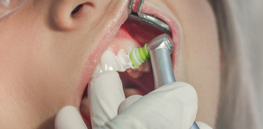 Produkt-Power: Individualisierte Prophylaxe mit System