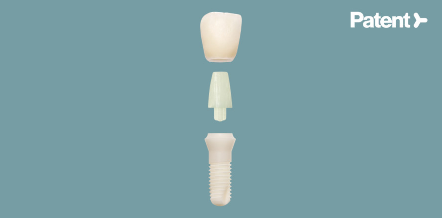 Periimplantitis vermeiden mit dem Patent™ Implantatsystem?