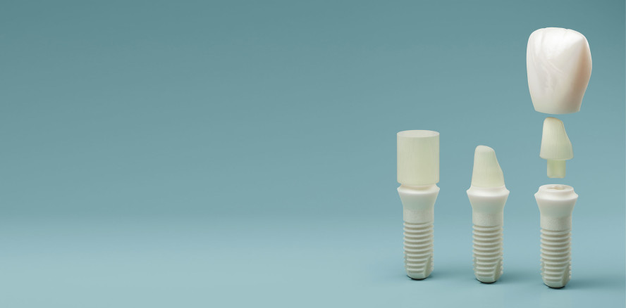 Erste Langzeitstudie zu zweiteiligen Zirkonoxidimplantaten