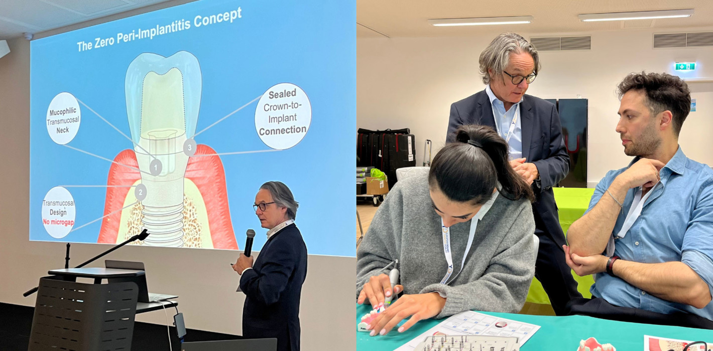 Periimplantitis beim Young Dentist Forum: Vermeiden statt behandeln!